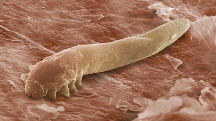 worm that lives under human skin