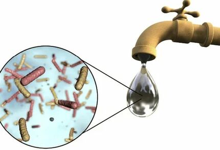 Parasites at a drop of water from the crane