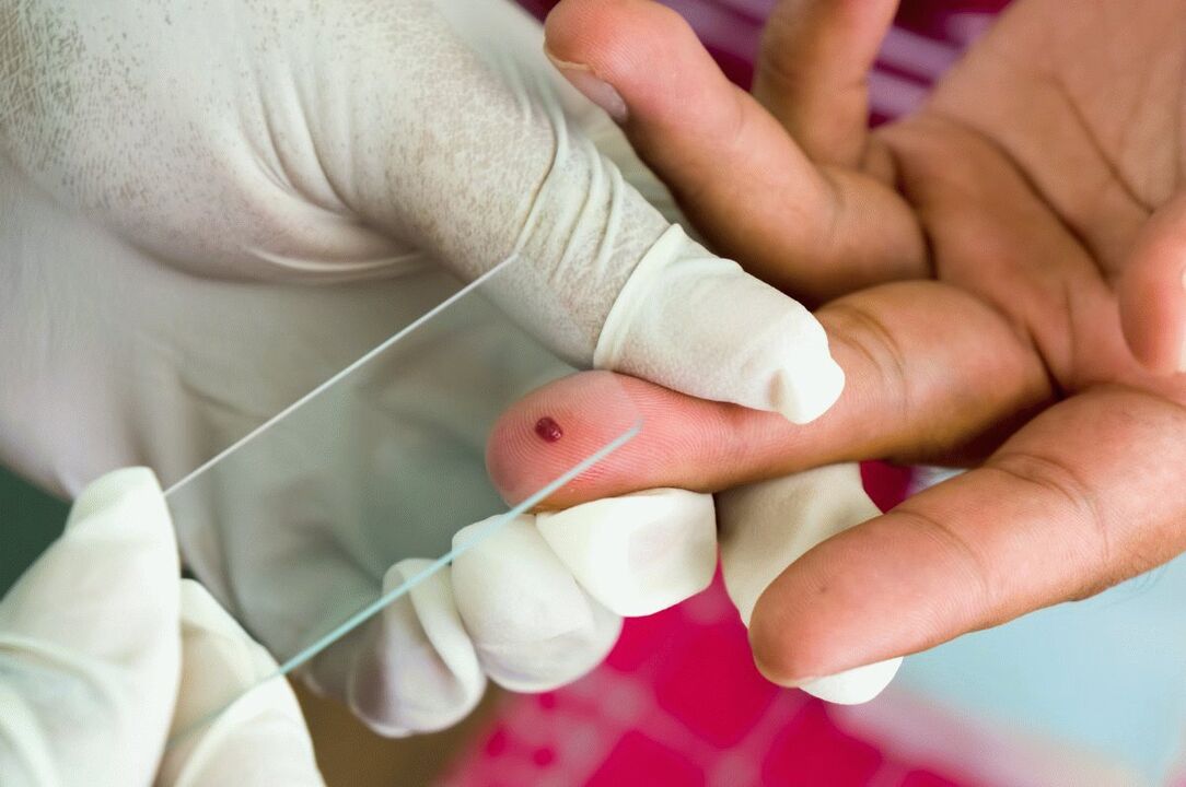 The blood test from the finger